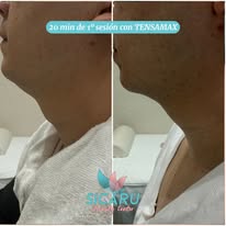 Antes y después 1